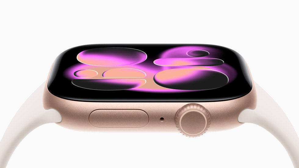 Apple Watch Series 10: Những kỳ vọng và tác động tại Pleiku